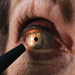 Screening sul glaucoma